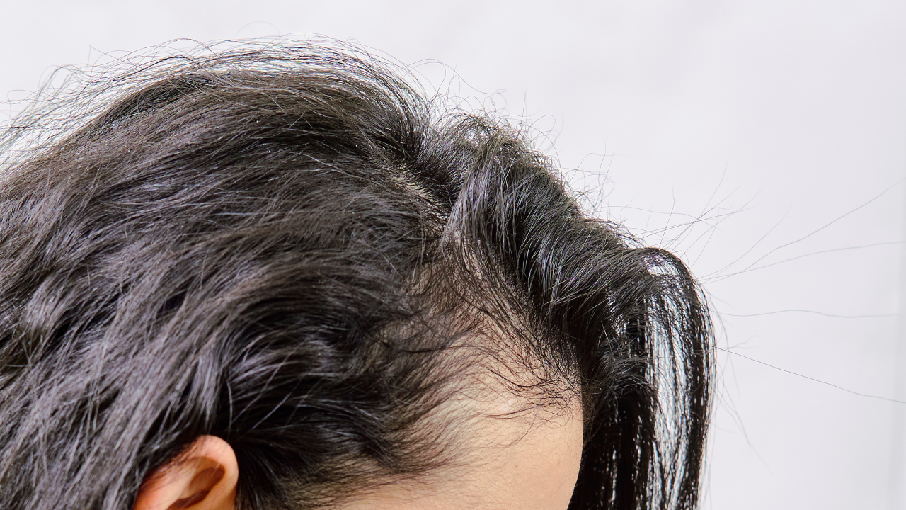 close up of woman's thinning hair at the scalp